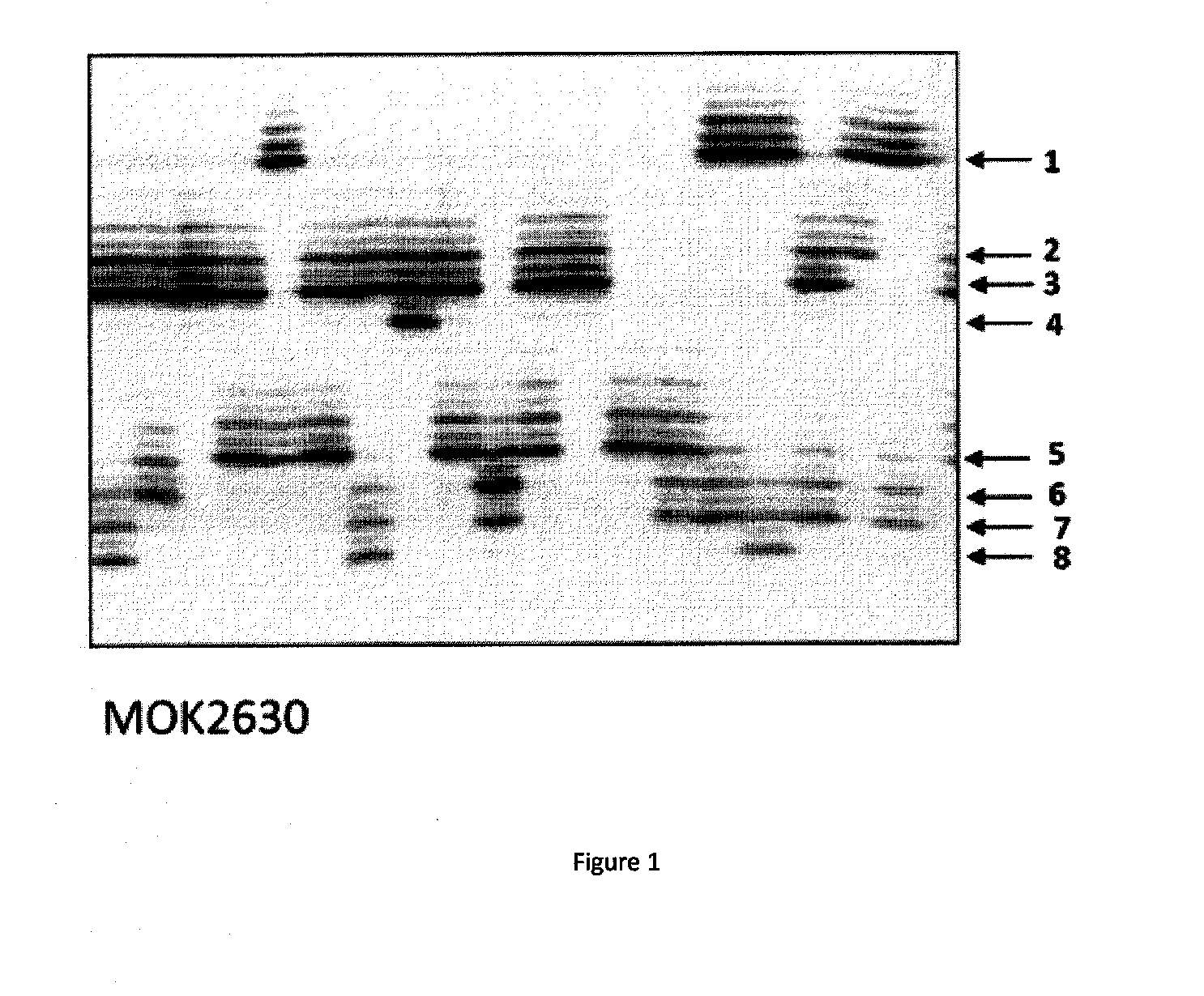Marker for diagnosing forelimb-girdle muscular anomaly in mammal individual, and detection method using same