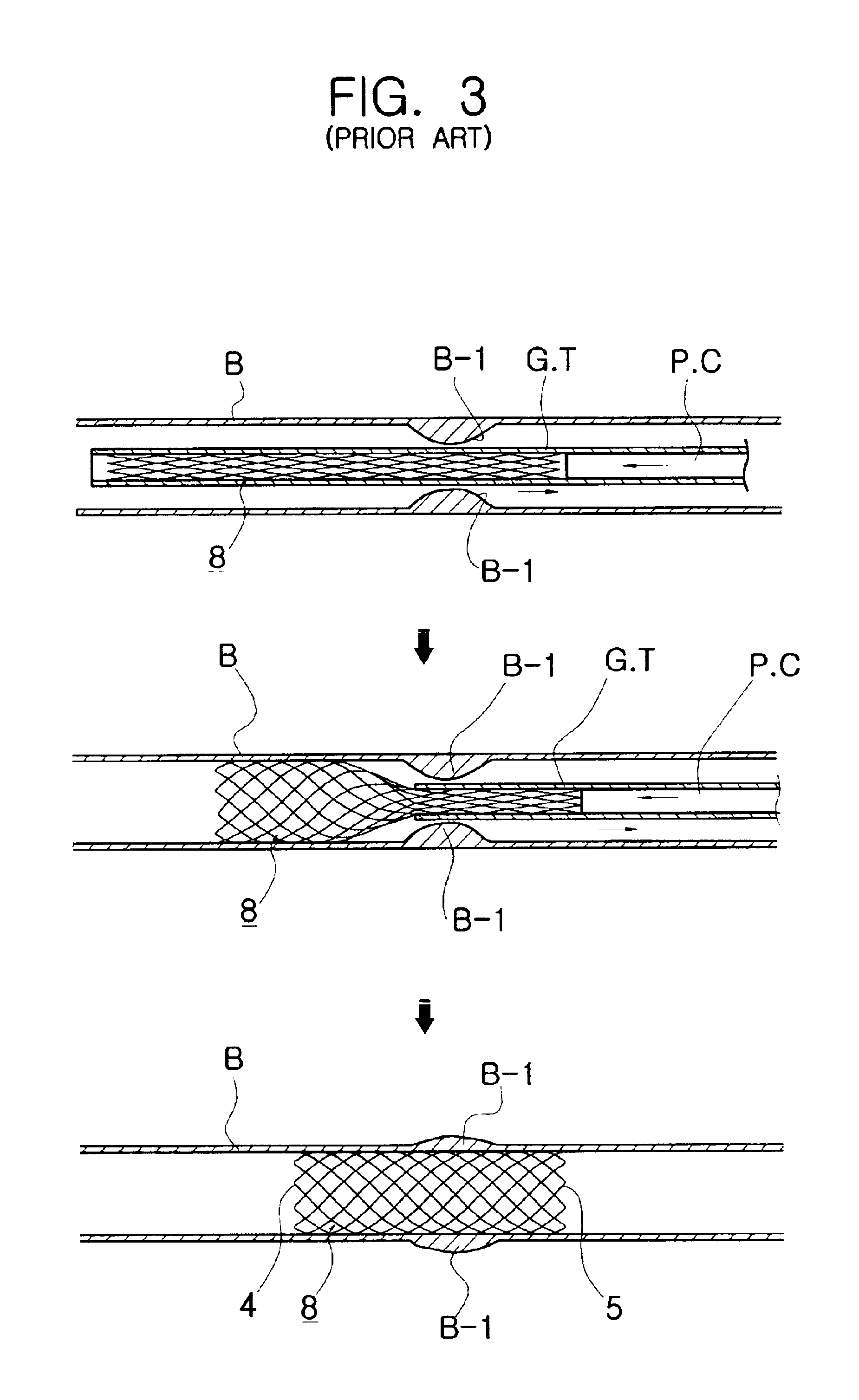 Flexible self-expandable stent using shape memory alloy and method and apparatus for fabricating the same
