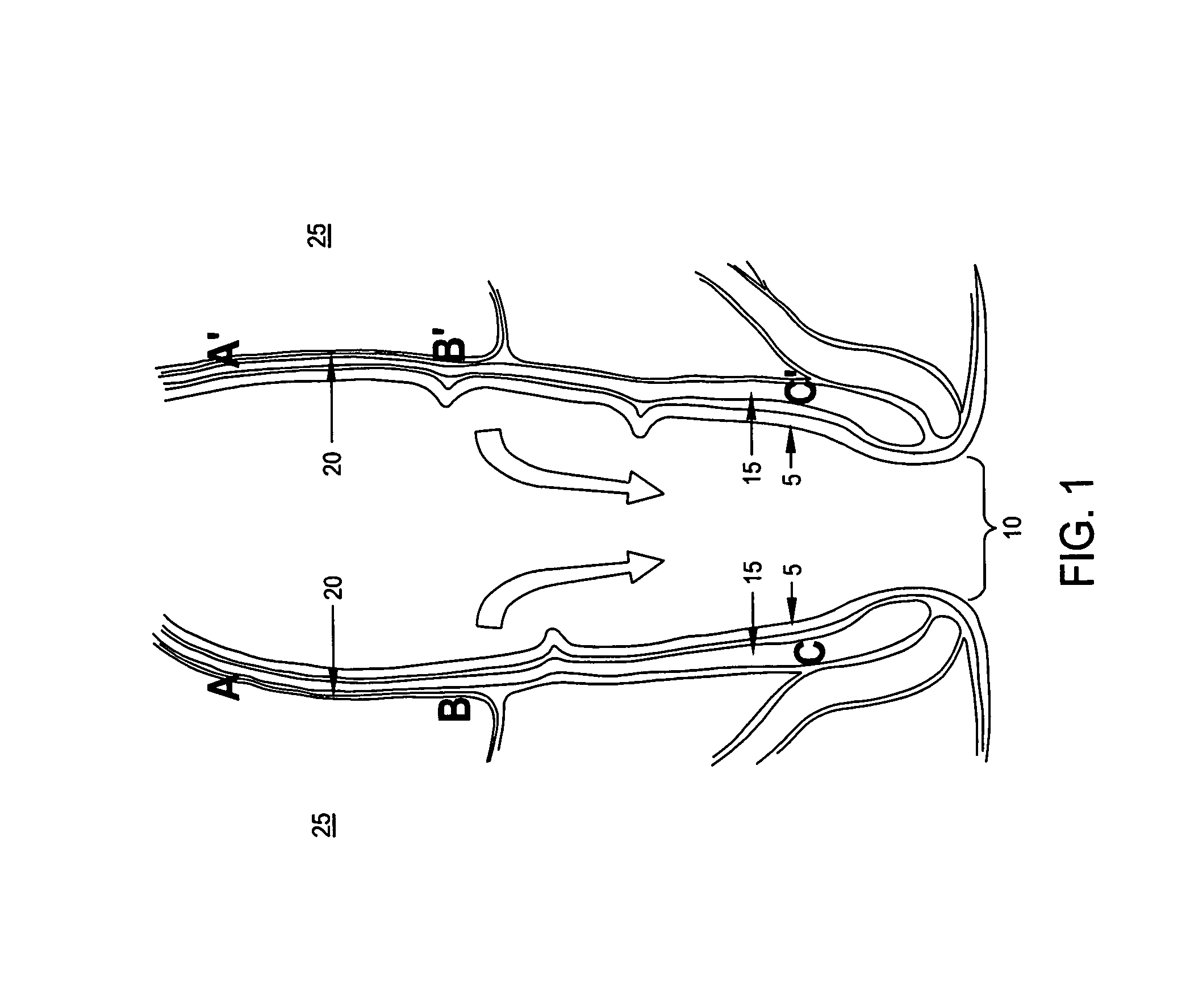 Method and apparatus for endoscopically treating rectal prolapse