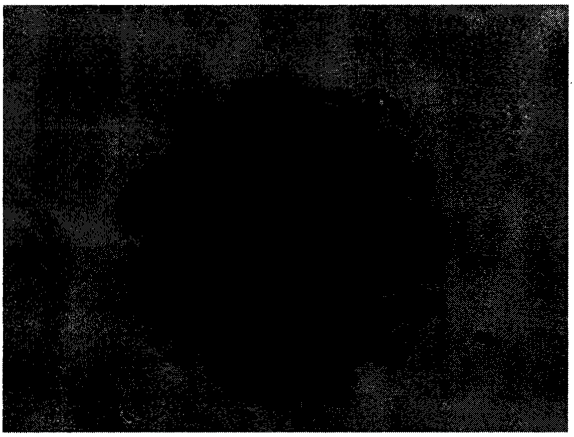 Preparation and application of a monoclonal antibody against alveolar coccoid cyst wall tissue (germinal layer, corneum cortex)