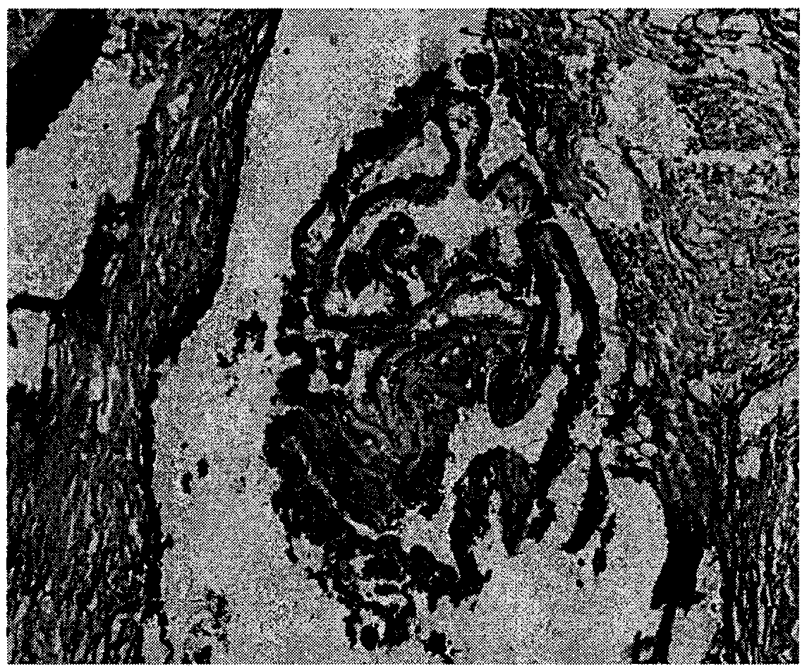 Preparation and application of a monoclonal antibody against alveolar coccoid cyst wall tissue (germinal layer, corneum cortex)