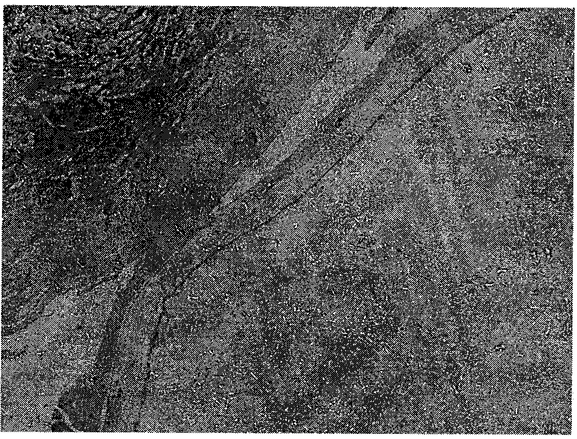 Preparation and application of a monoclonal antibody against alveolar coccoid cyst wall tissue (germinal layer, corneum cortex)