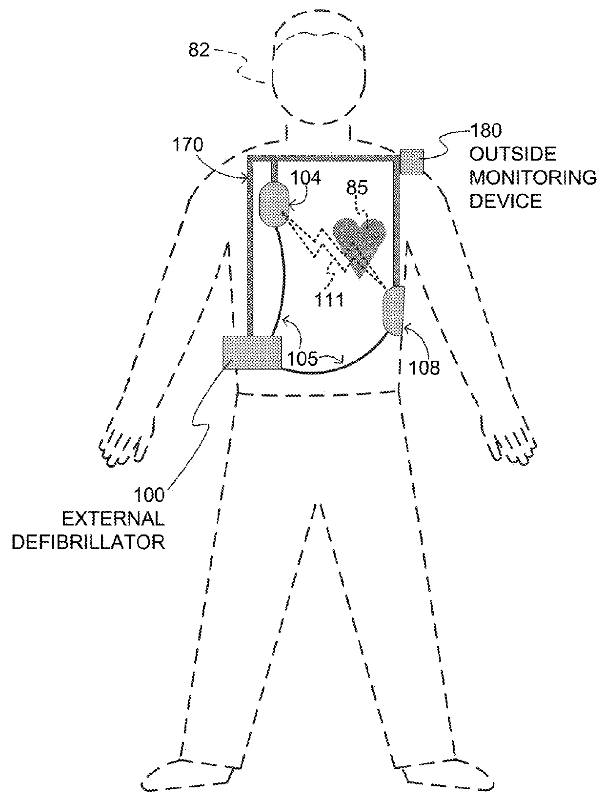 Wearable cardioverter defibrillator (WCD) with power-saving function