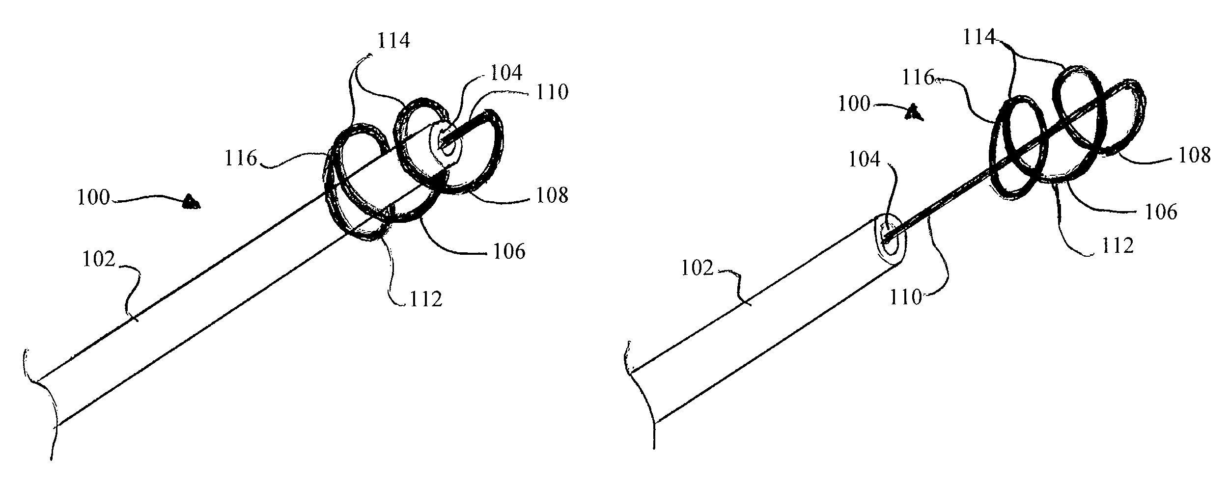 Twist-in spring-skirt-like sphincterotome