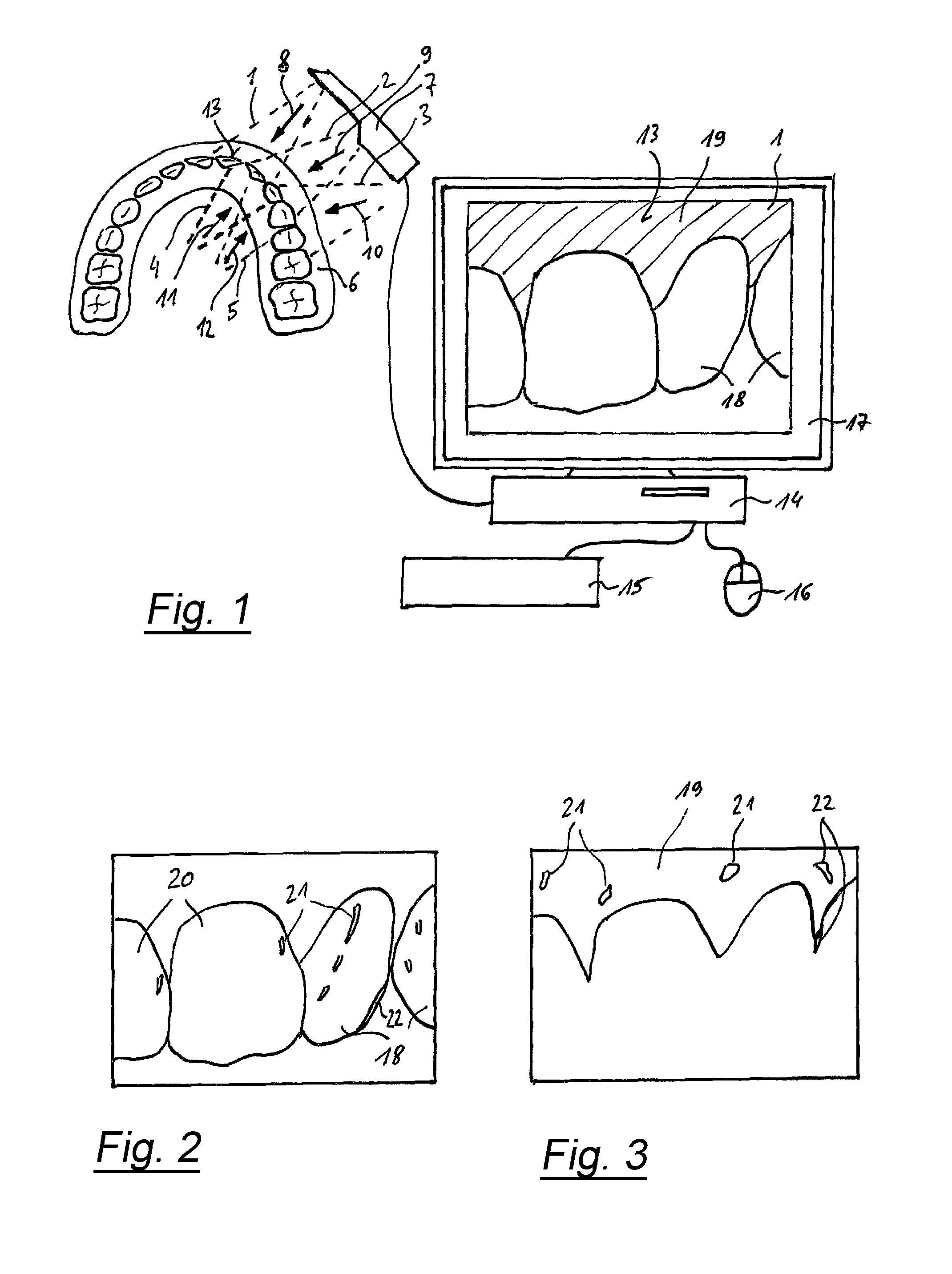 Method for recording multiple three-dimensional images of a dental object