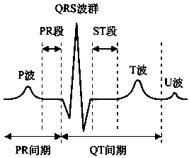 ECG signal feature selection method and system based on memetic algorithm