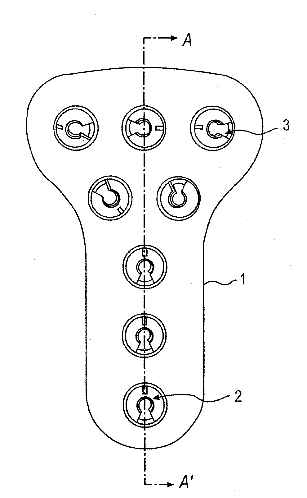 Cross pin fixator for bone fragments and use thereof