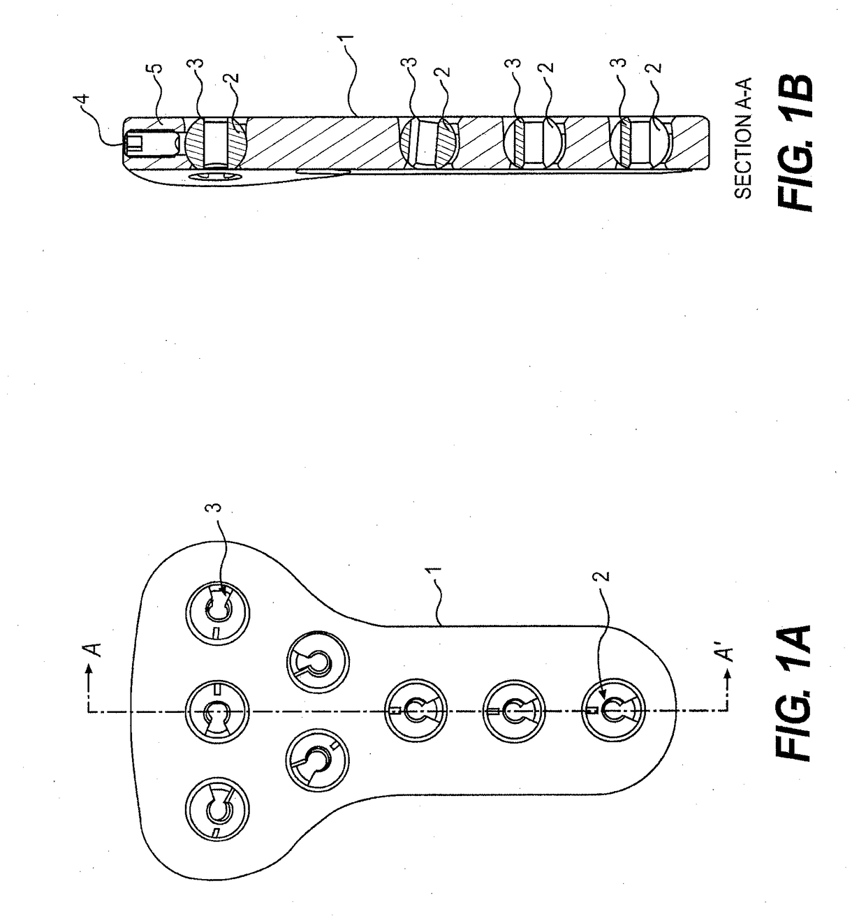 Cross pin fixator for bone fragments and use thereof