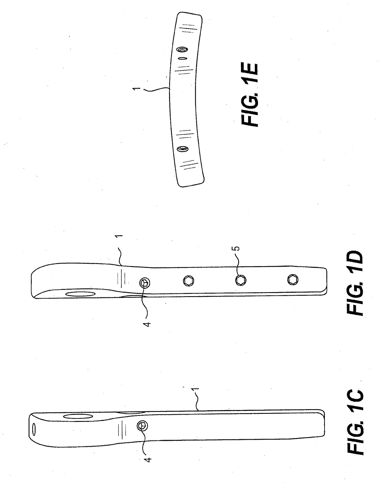 Cross pin fixator for bone fragments and use thereof