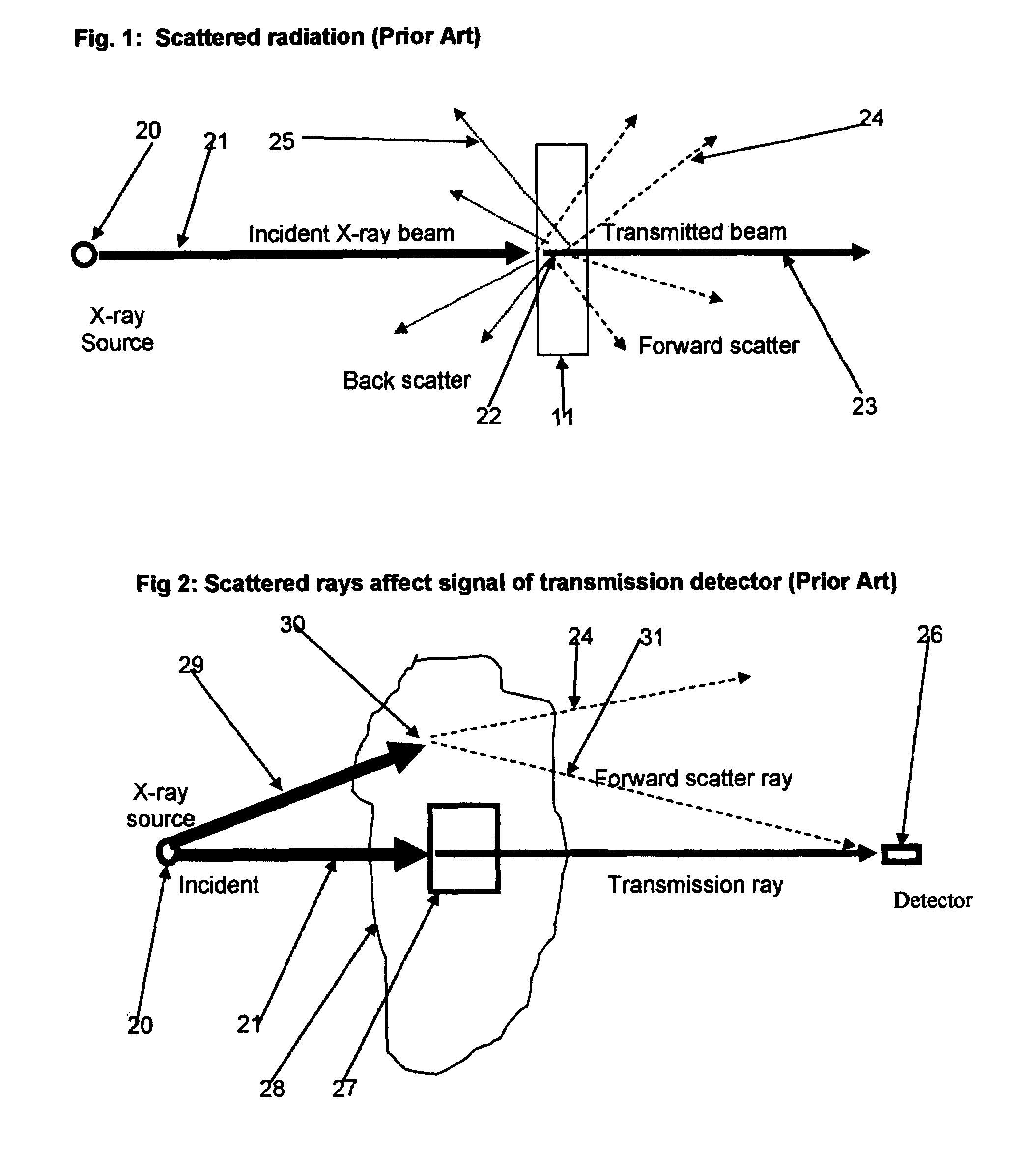Back-scattered X-ray radiation attenuation method and apparatus