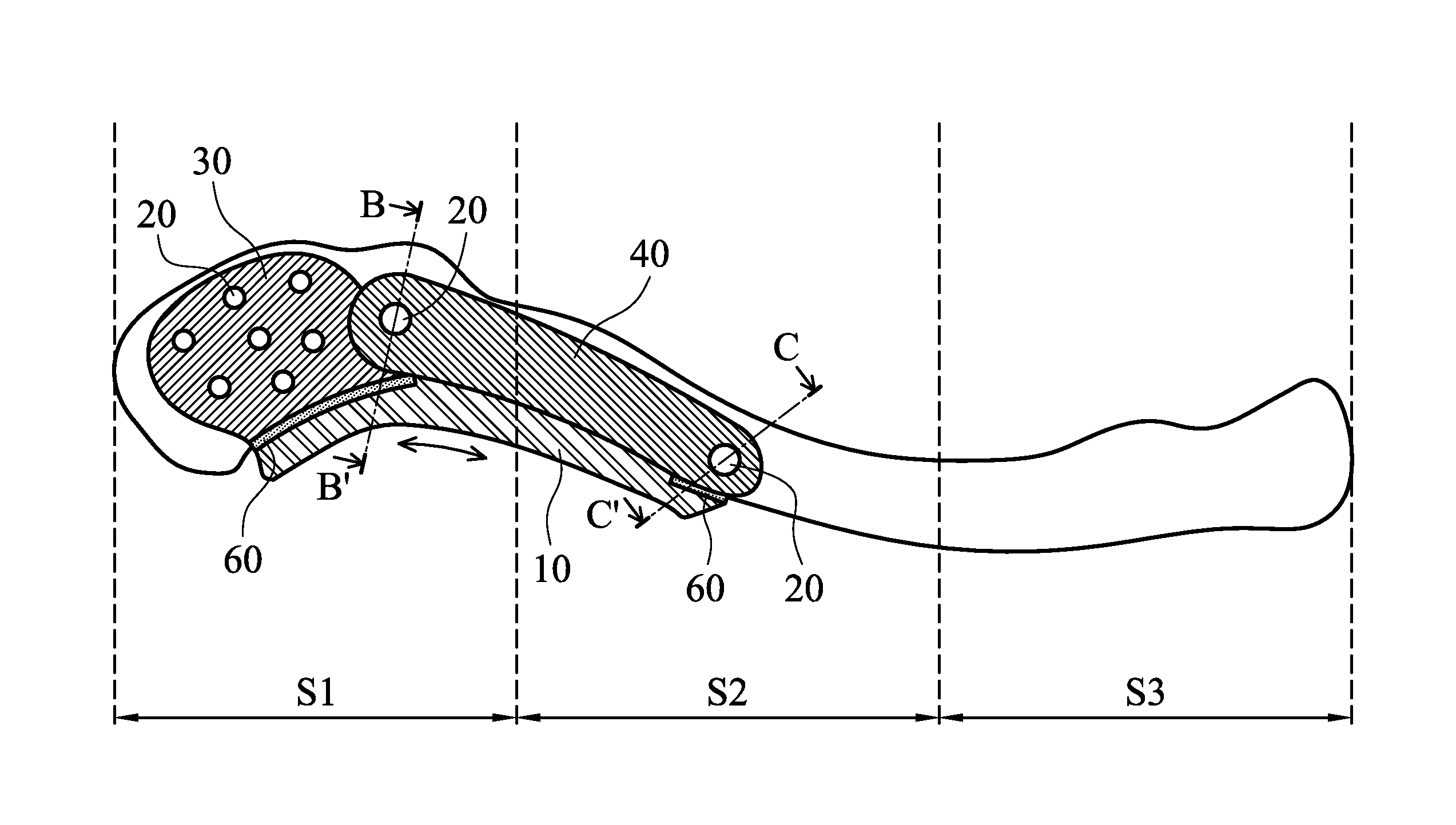 Three-dimensional fracture fixation device for nerve protection