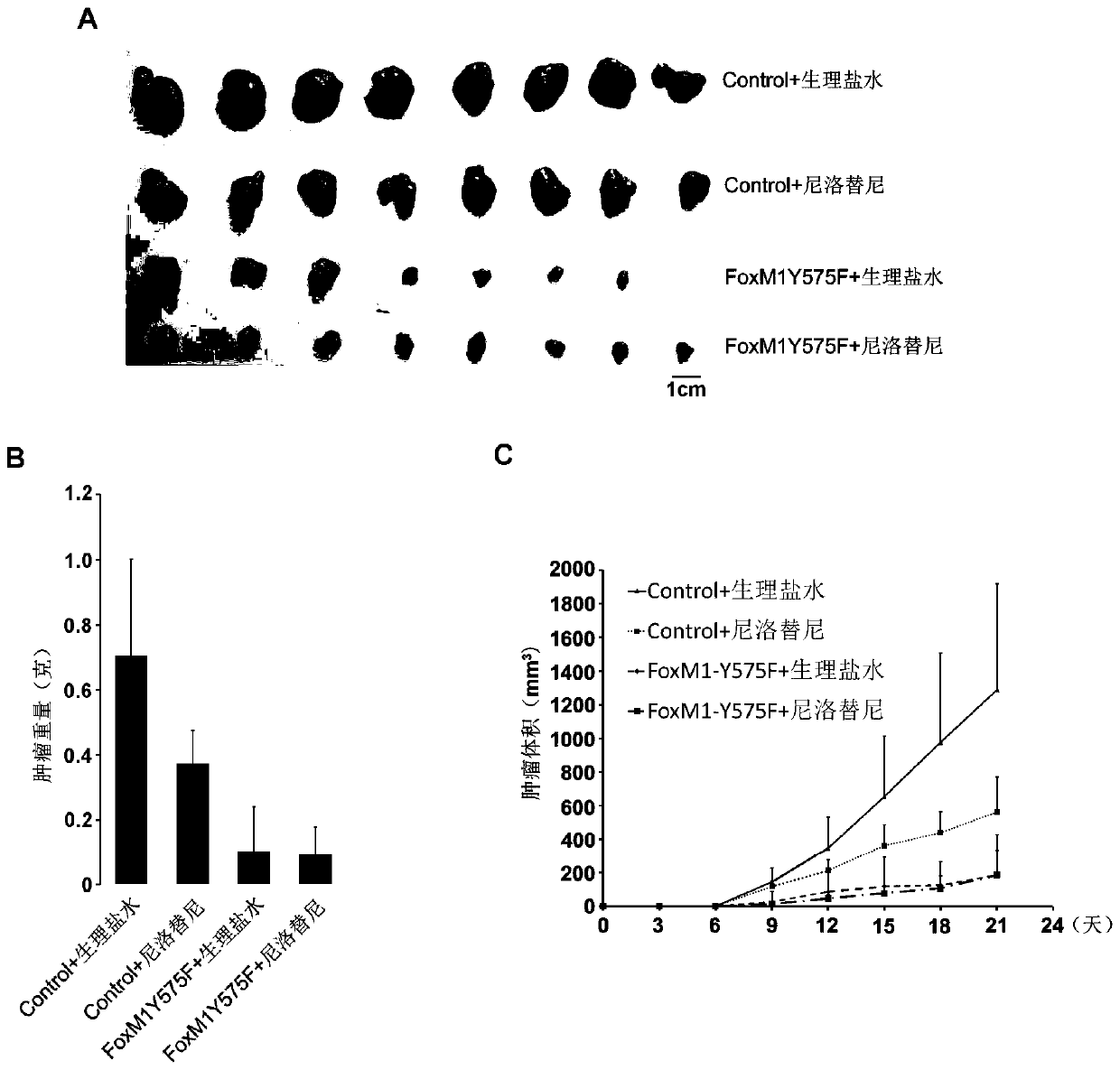Application of c-Abl kinase inhibitor in FoxM1 high-expression tumor treatment