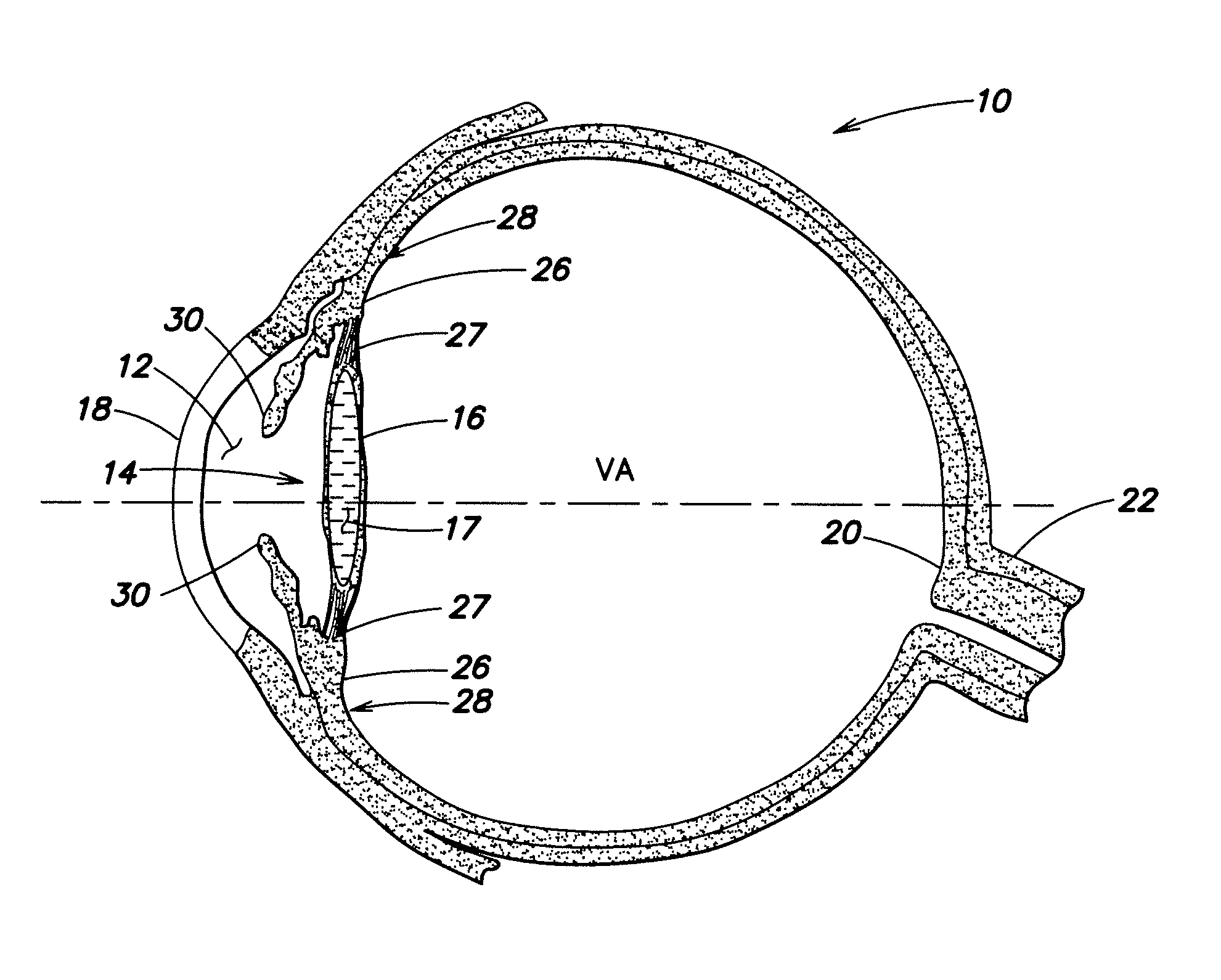 Multi-element accommodative intraocular lens