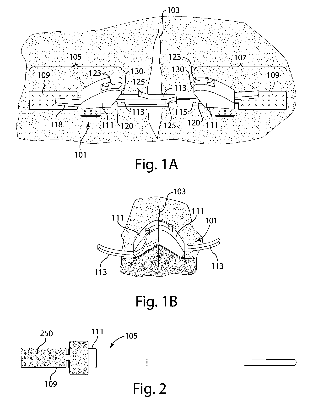 Devices for securely closing tissue openings with minimized scarring
