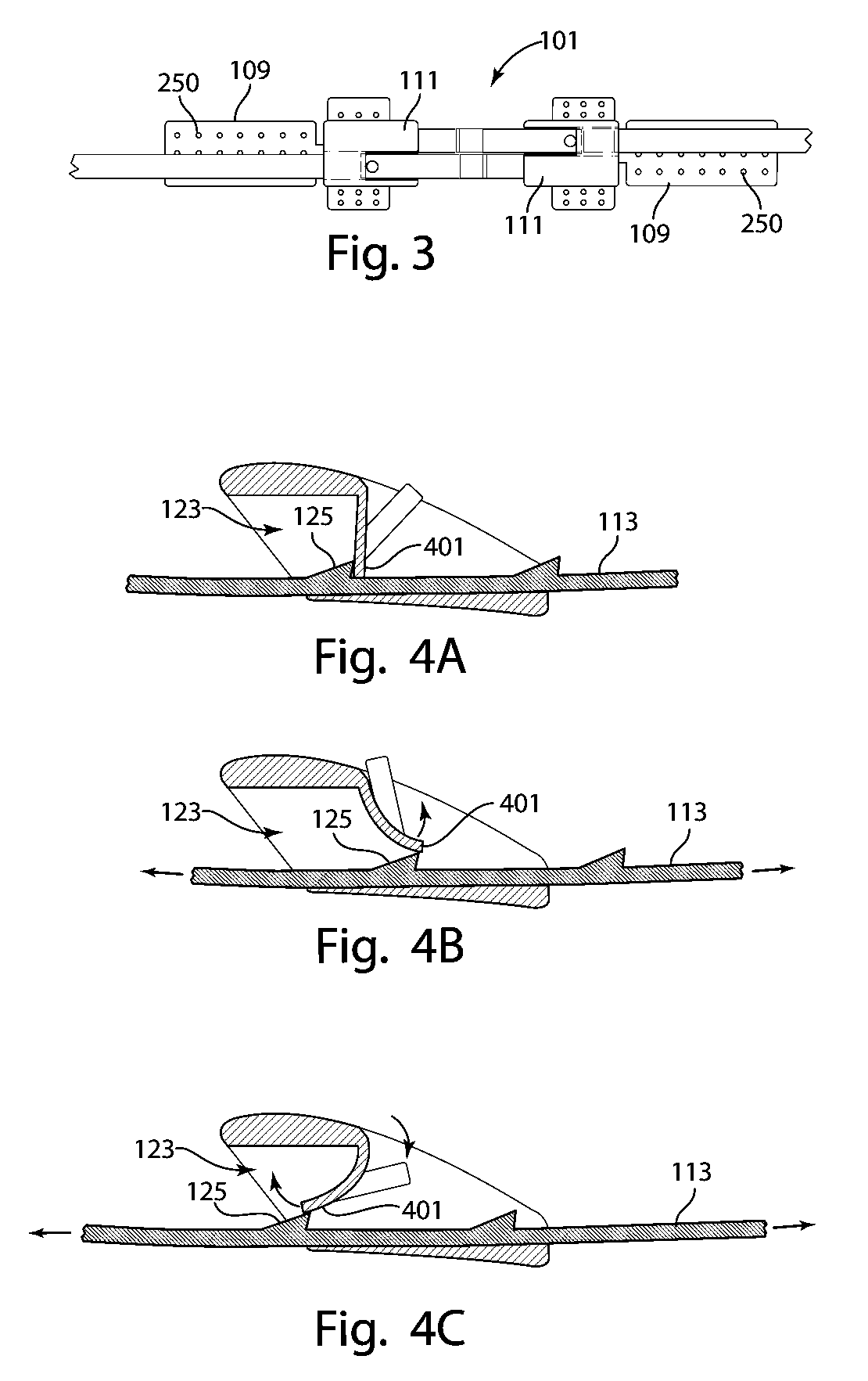 Devices for securely closing tissue openings with minimized scarring