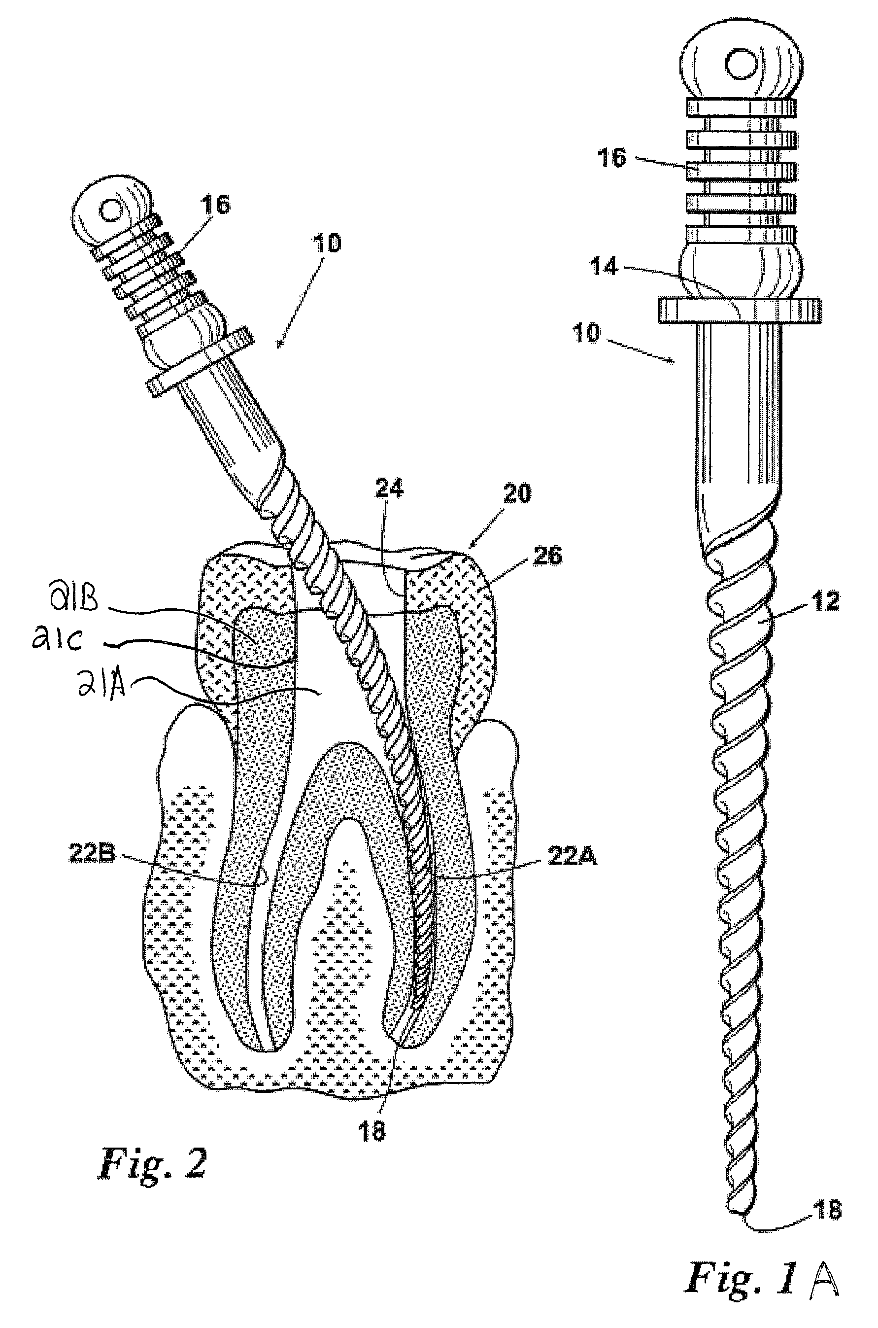 Endodontic instruments and methods of manufacturing thereof