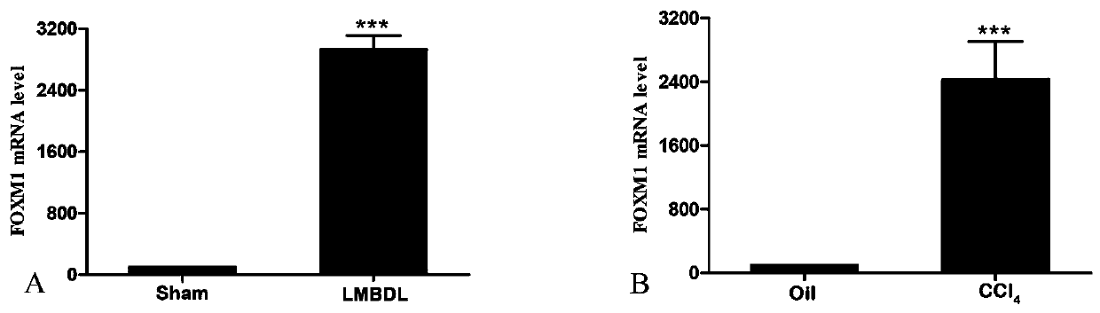 Application of foxm1 inhibitor fdi-6 against liver fibrosis