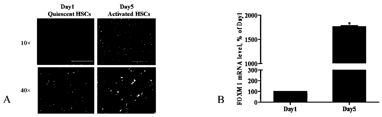 Application of foxm1 inhibitor fdi-6 against liver fibrosis