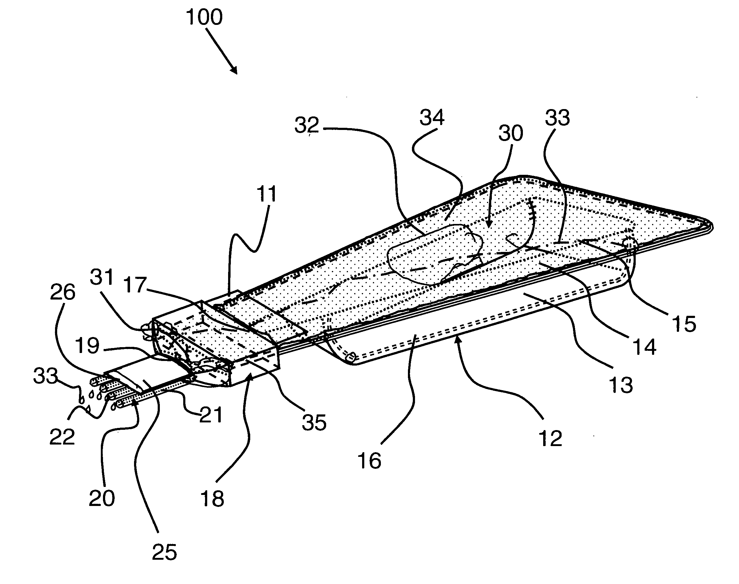 Direct delivery applicator assembly and method of use