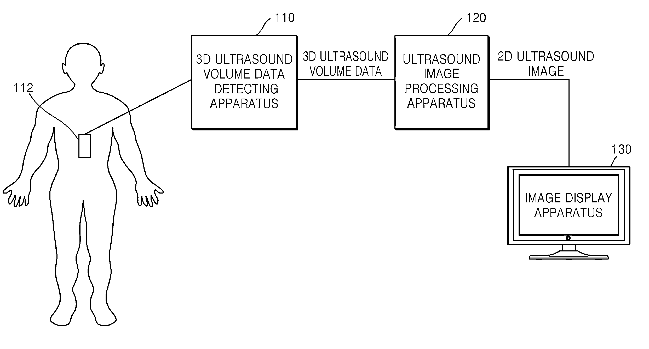 Method and apparatus for processing ultrasound image