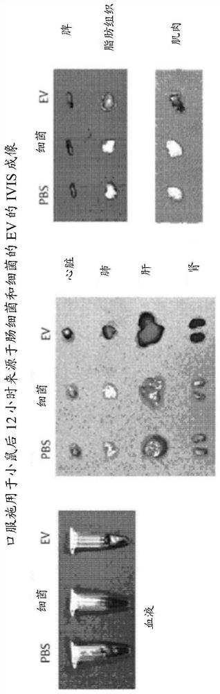 Method for diagnosing cholangiocarcinoma via bacterial metagenomic analysis