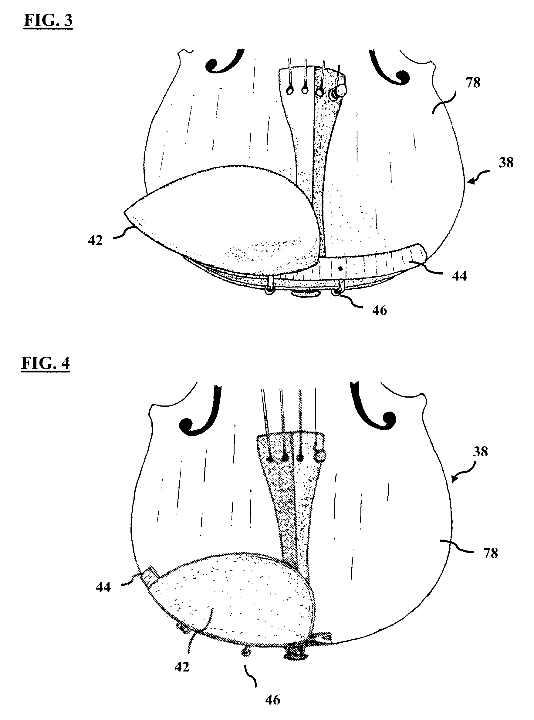 Chinrest device for musical instrument, method and kit