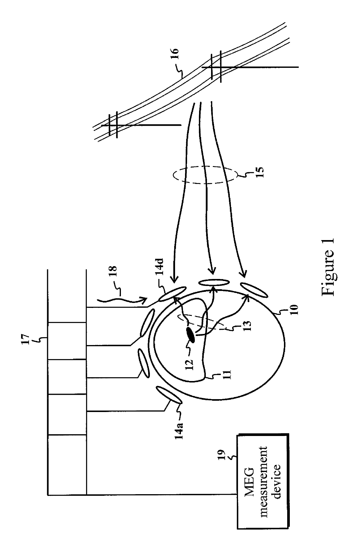 Method and device for recognizing and removing undesired artifacts in multichannel magnetic field or electric potential measurements
