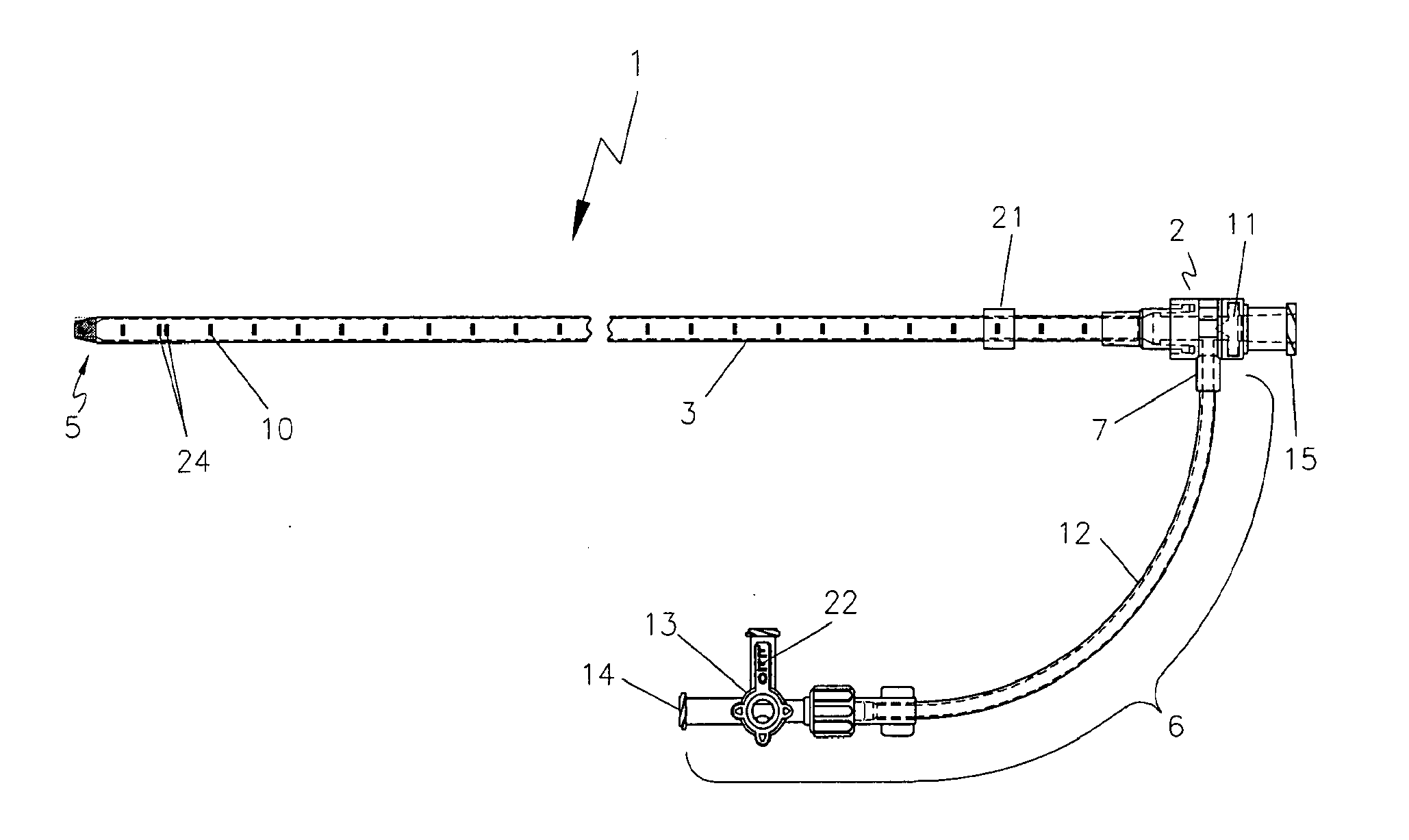 Endovascular Treatment Apparatus and Method