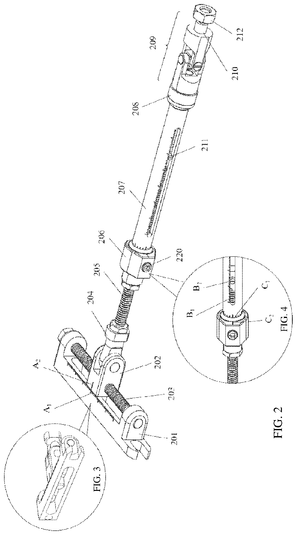 Freely-connectable three-strut parallel orthopedic external fixator