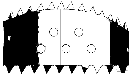 An absorbable cervical intervertebral fusion device and its preparation method