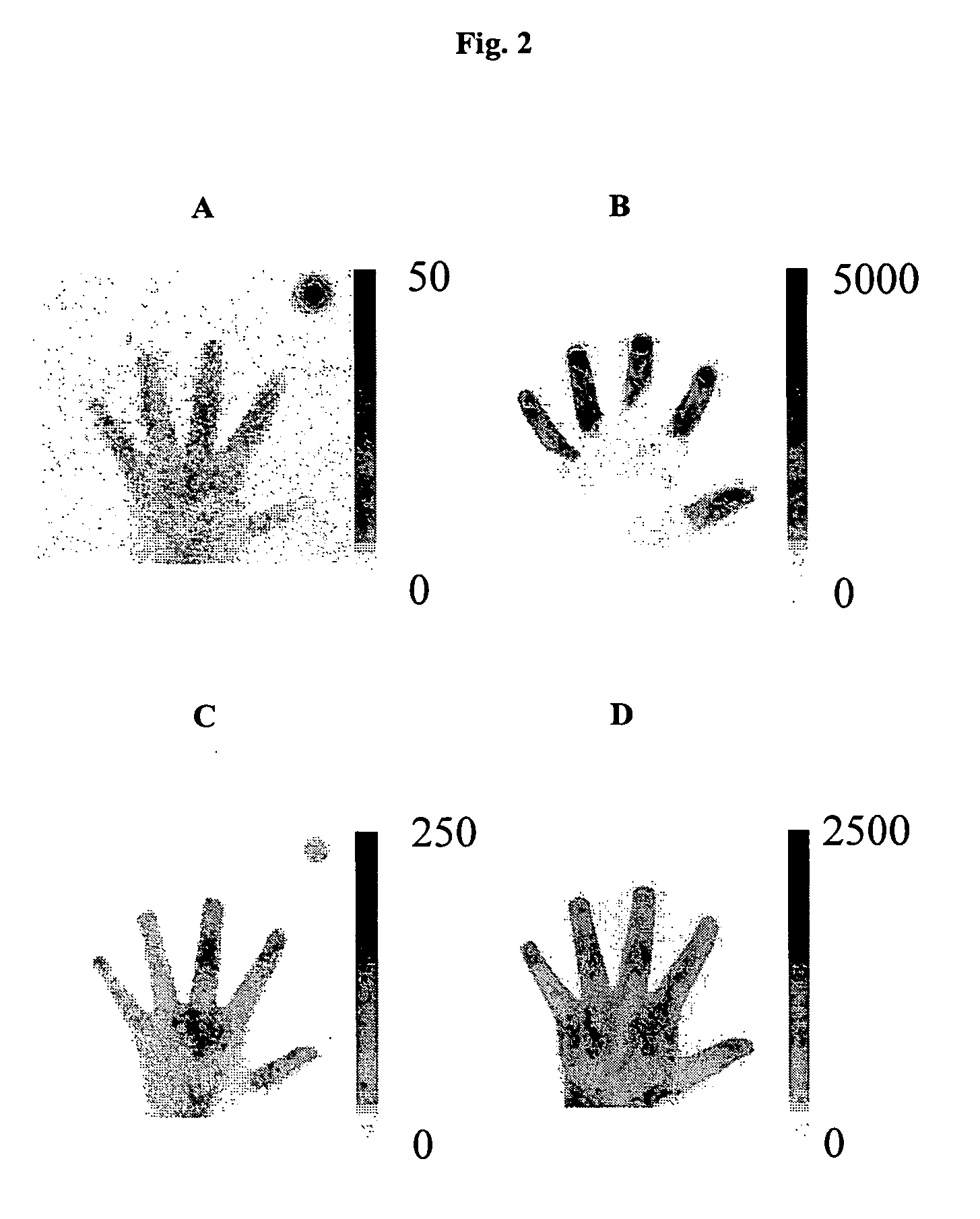 Optical imaging of rheumatoid arthritis