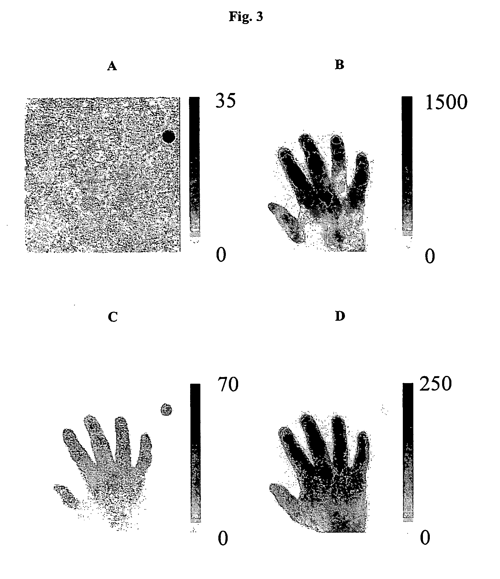 Optical imaging of rheumatoid arthritis