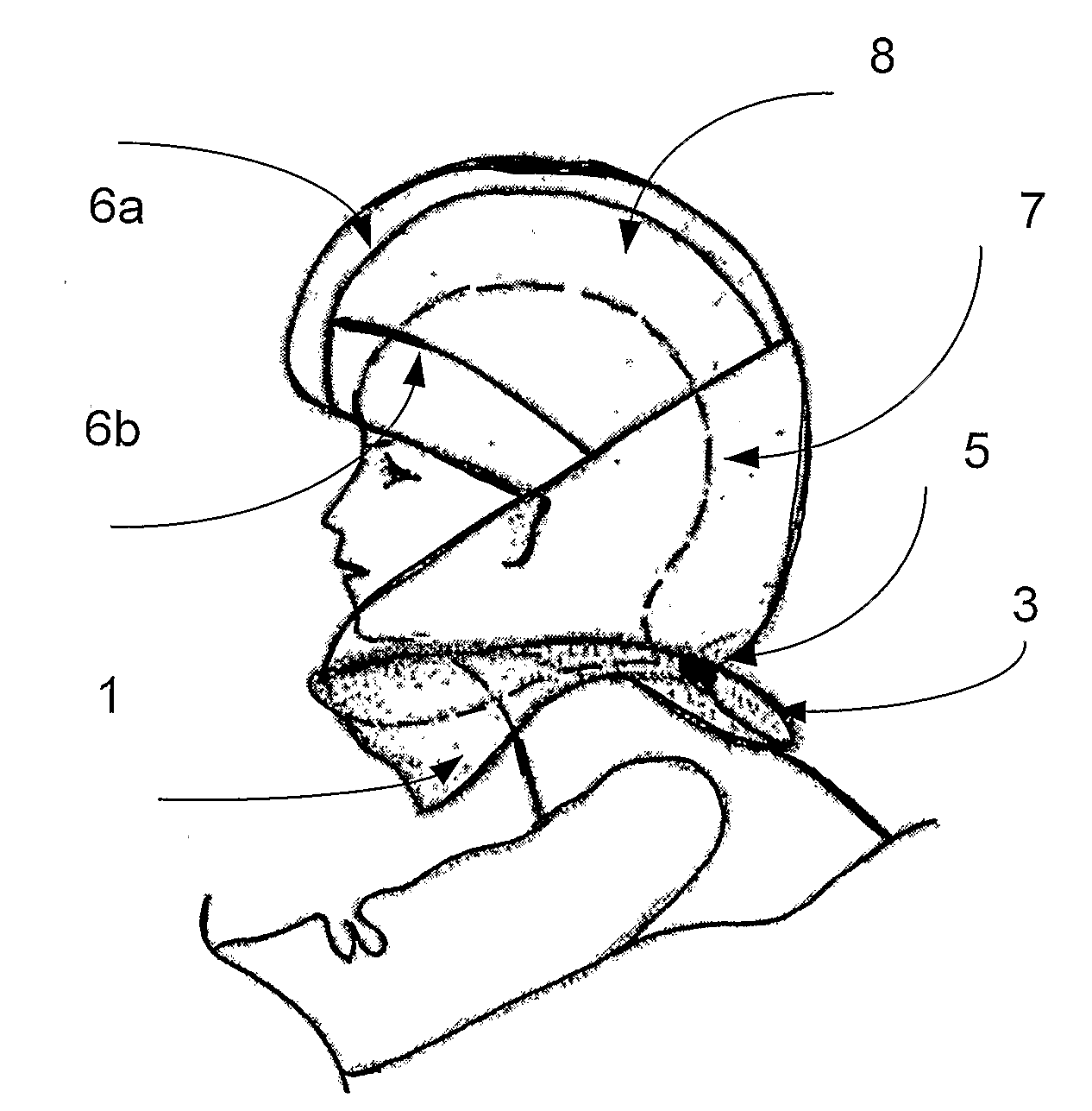 System and Method for Protecting a Bodypart