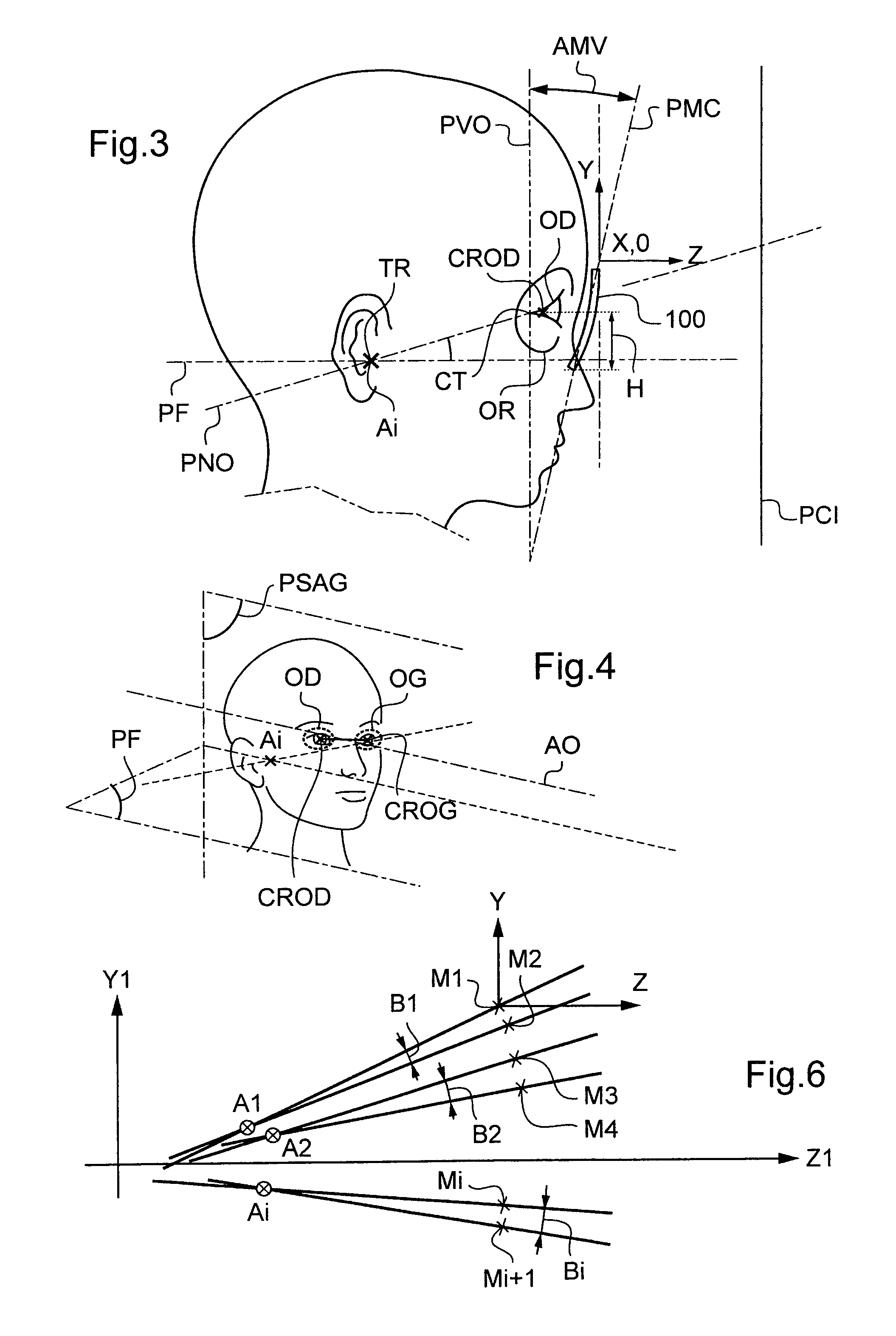 Method for determining at least one geometric postural parameter when fitting a corrective spectacle frame on the face of a wearer in the anatomical posture thereof