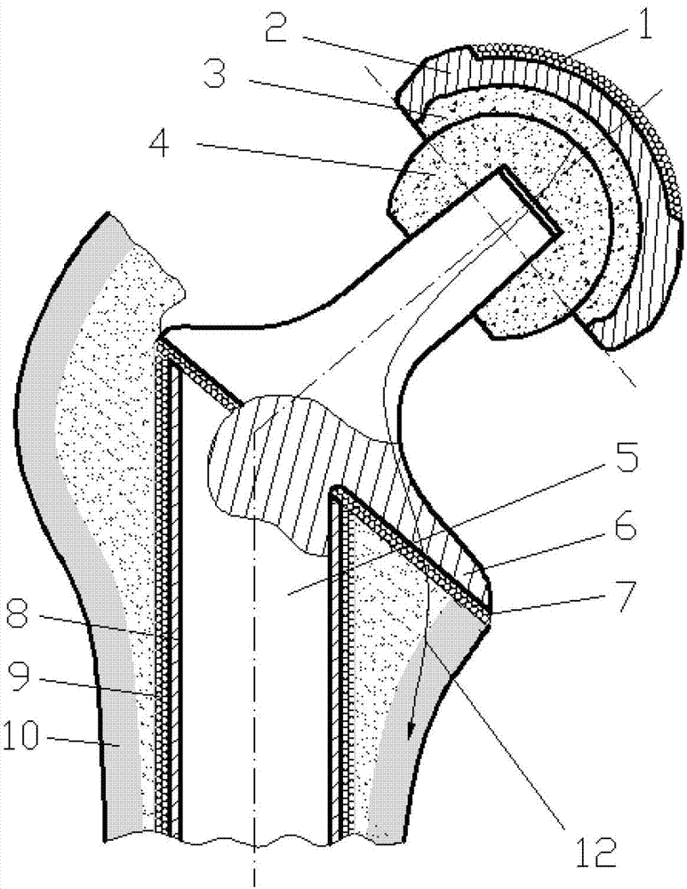 Novel artificial hip joint and manufacturing method thereof