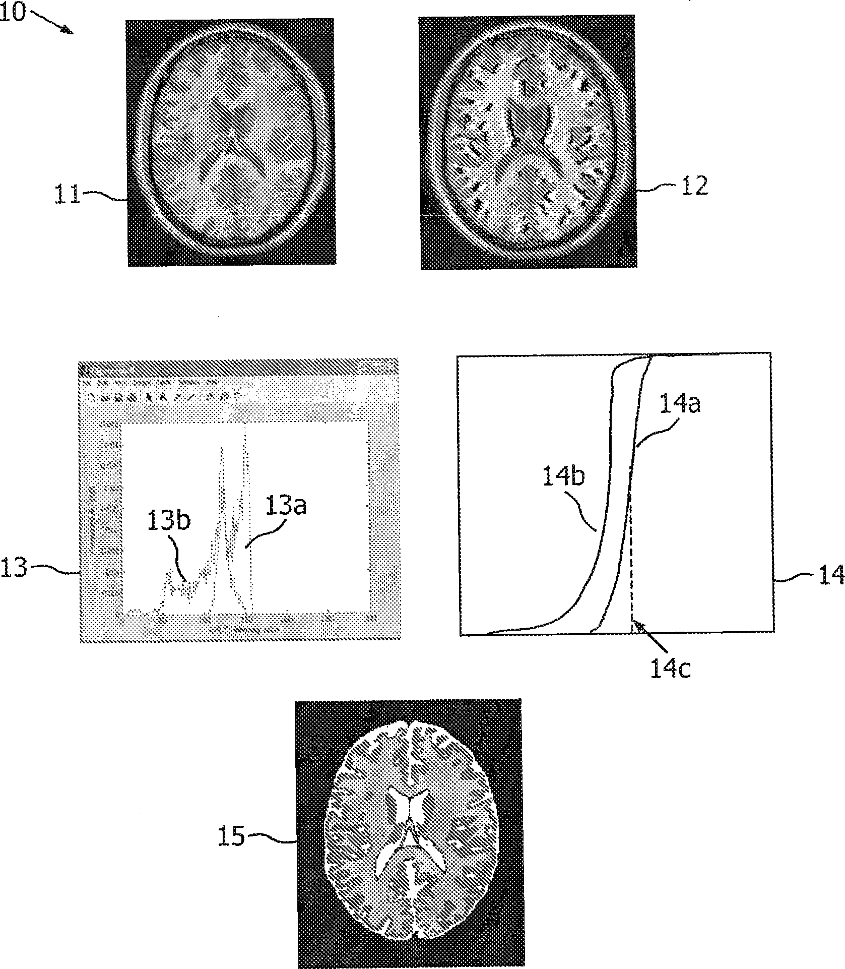 A method, a system and a computer program for determining a threshold in an image comprising image values