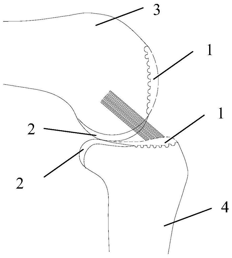 Knee joint operation auxiliary device