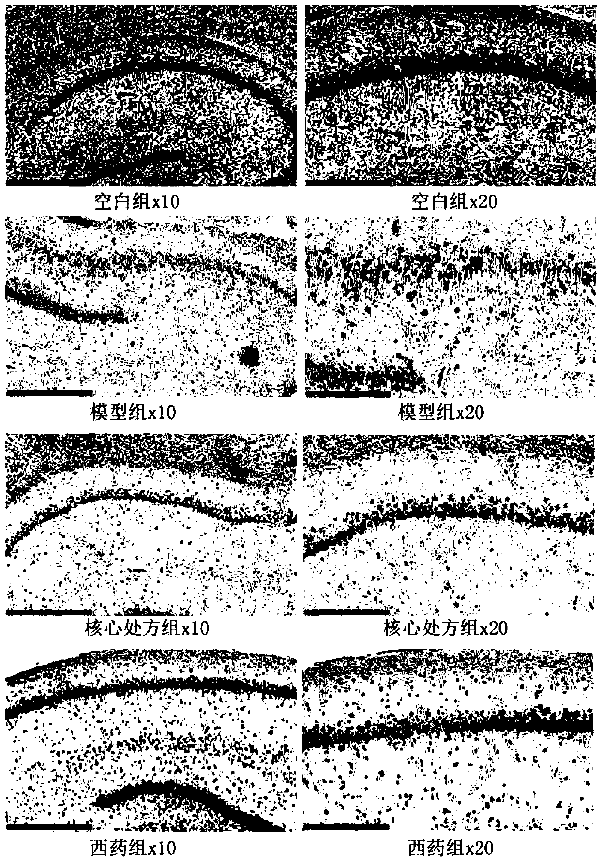 Traditional Chinese medicine composition for promoting regeneration of hippocampal neurons