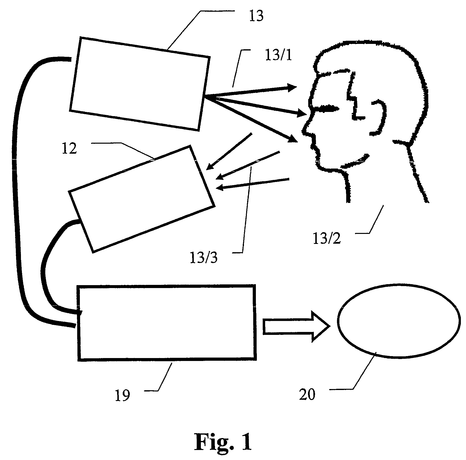 Color edge based system and method for determination of 3D surface topology