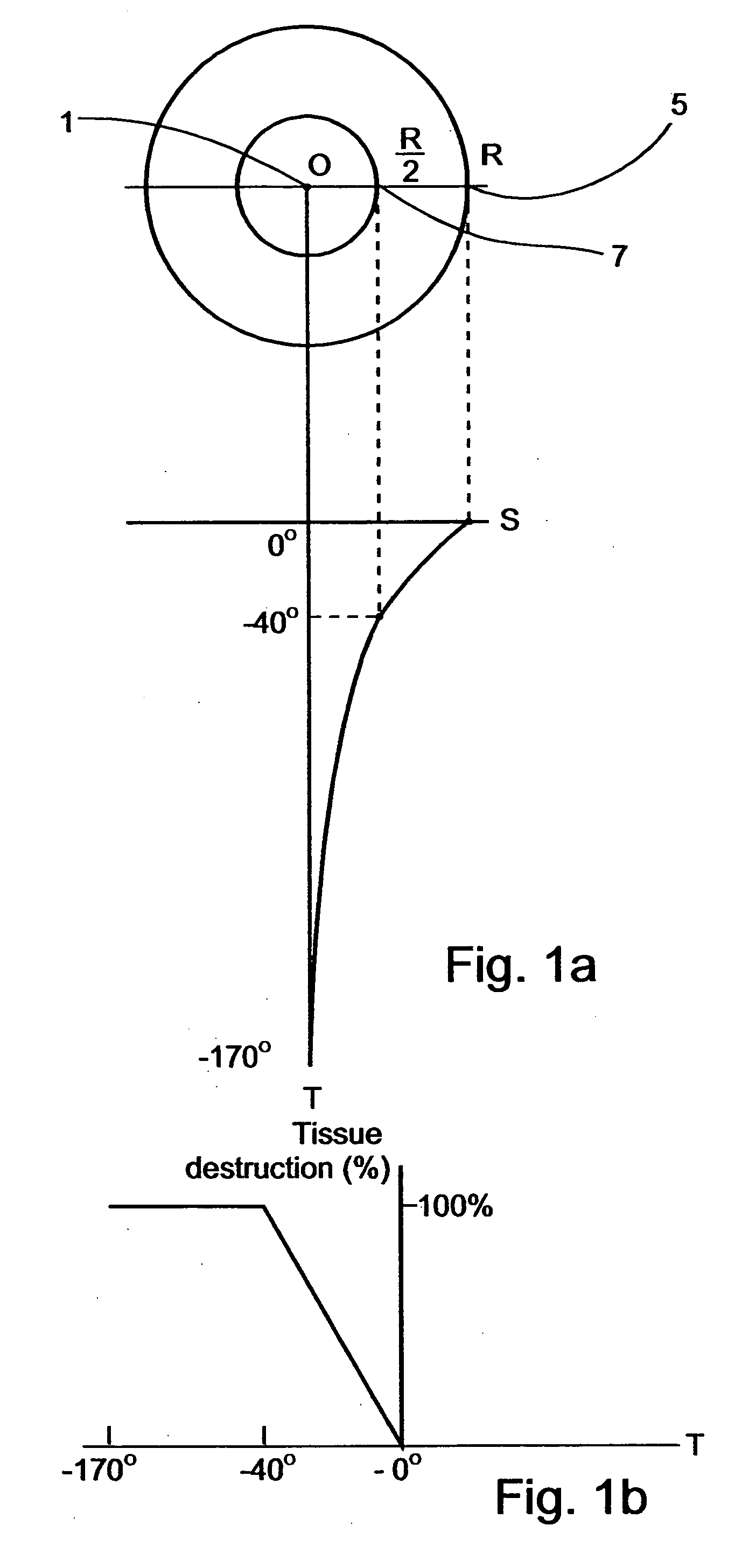 Method for delimiting cryoablation by controlled cooling