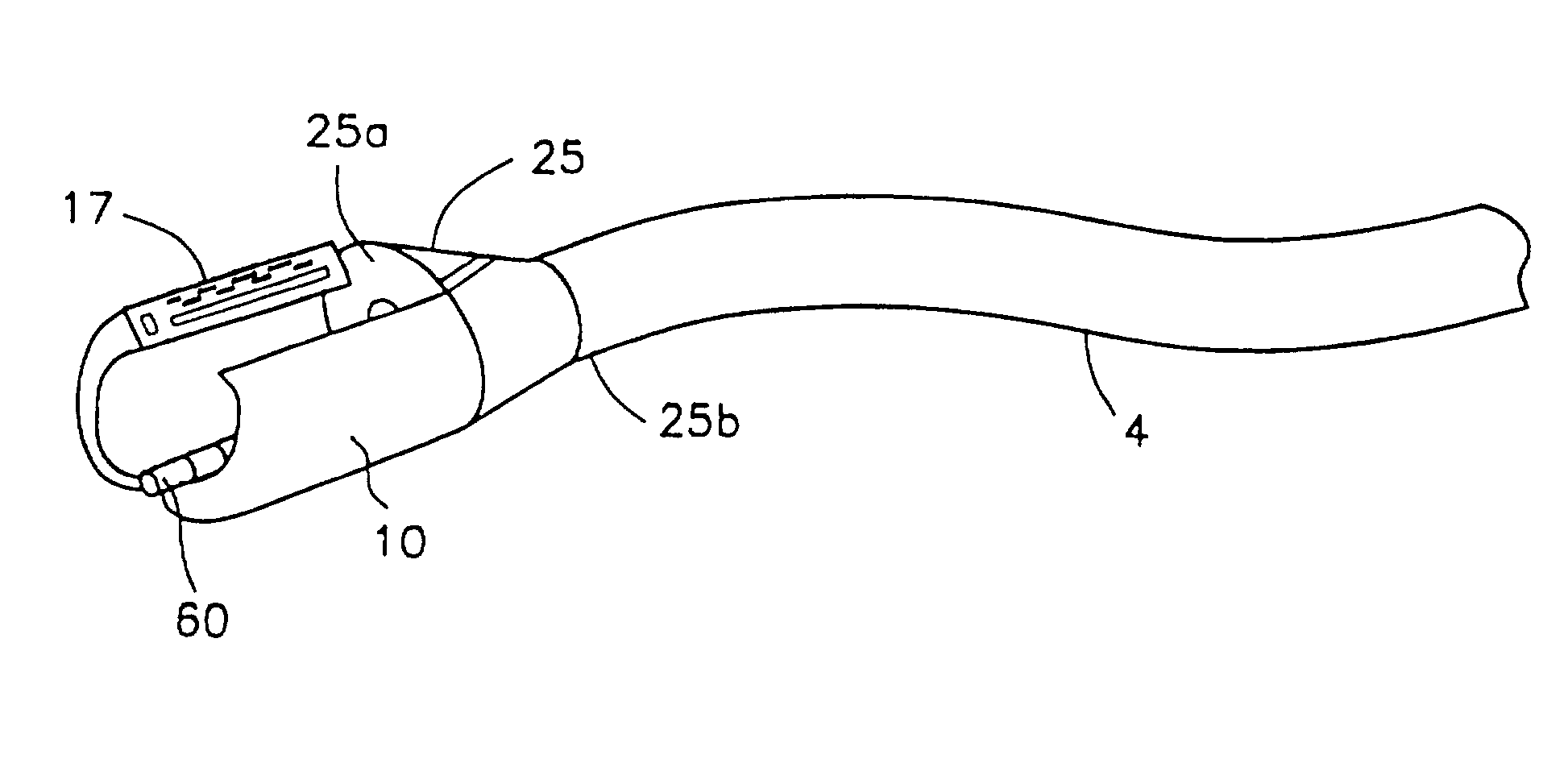 Method and device for full thickness resectioning of an organ