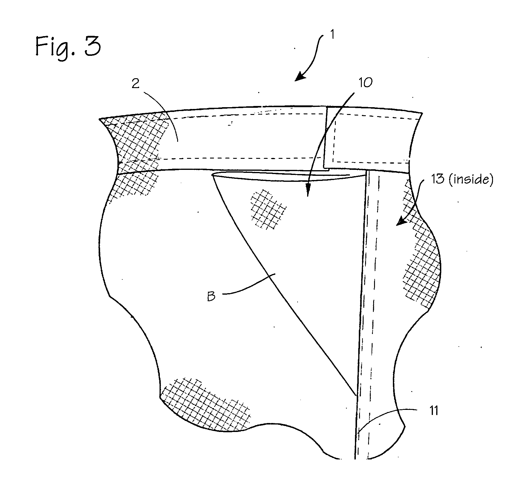 Garment with improved fly closure