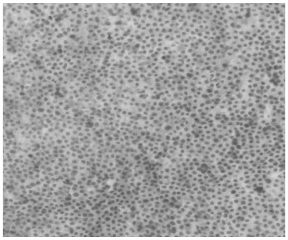 A kind of decellularized biological amniotic membrane comprising loose layer and preparation method thereof