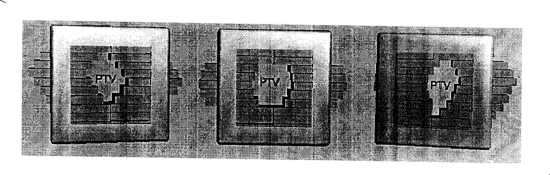 Method for patient target region automatically positioning in radiation therapy