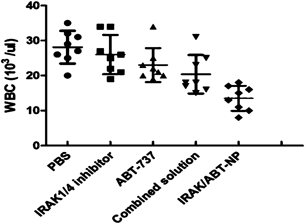 Compound nano preparation for treating T cell acute lymphoblastic leukemia, preparation method and application