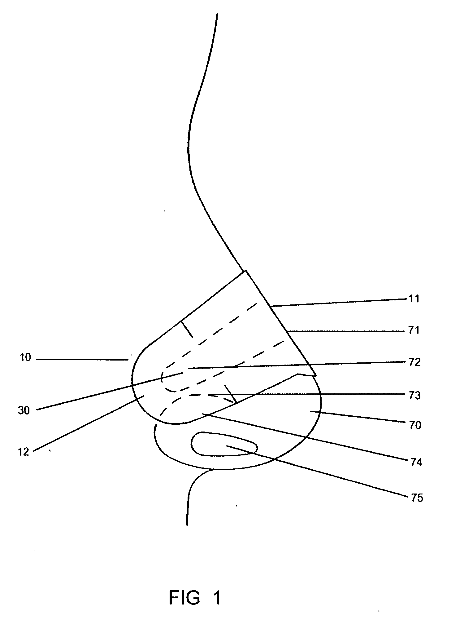Nasal dilator with cushion layer and variable spring rate