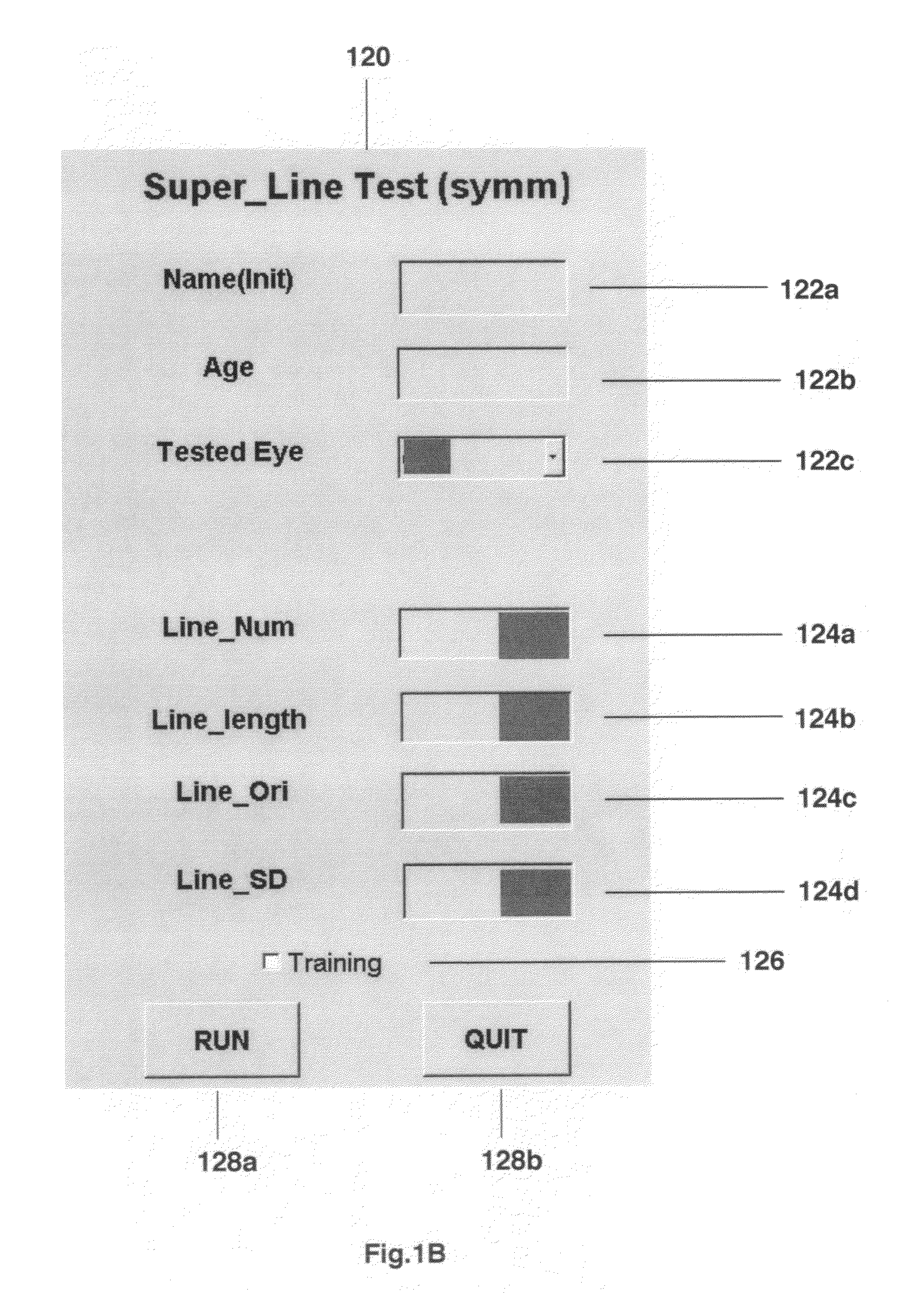 System and method for detecting central retinal distortions associated with macular diseases
