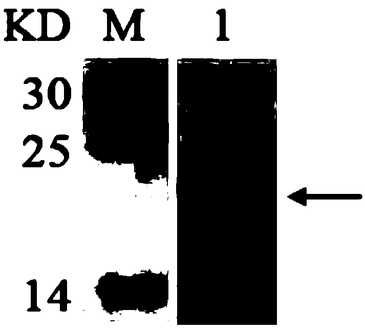 Human HLA-F monoclonal antibody as well as preparation method and application thereof