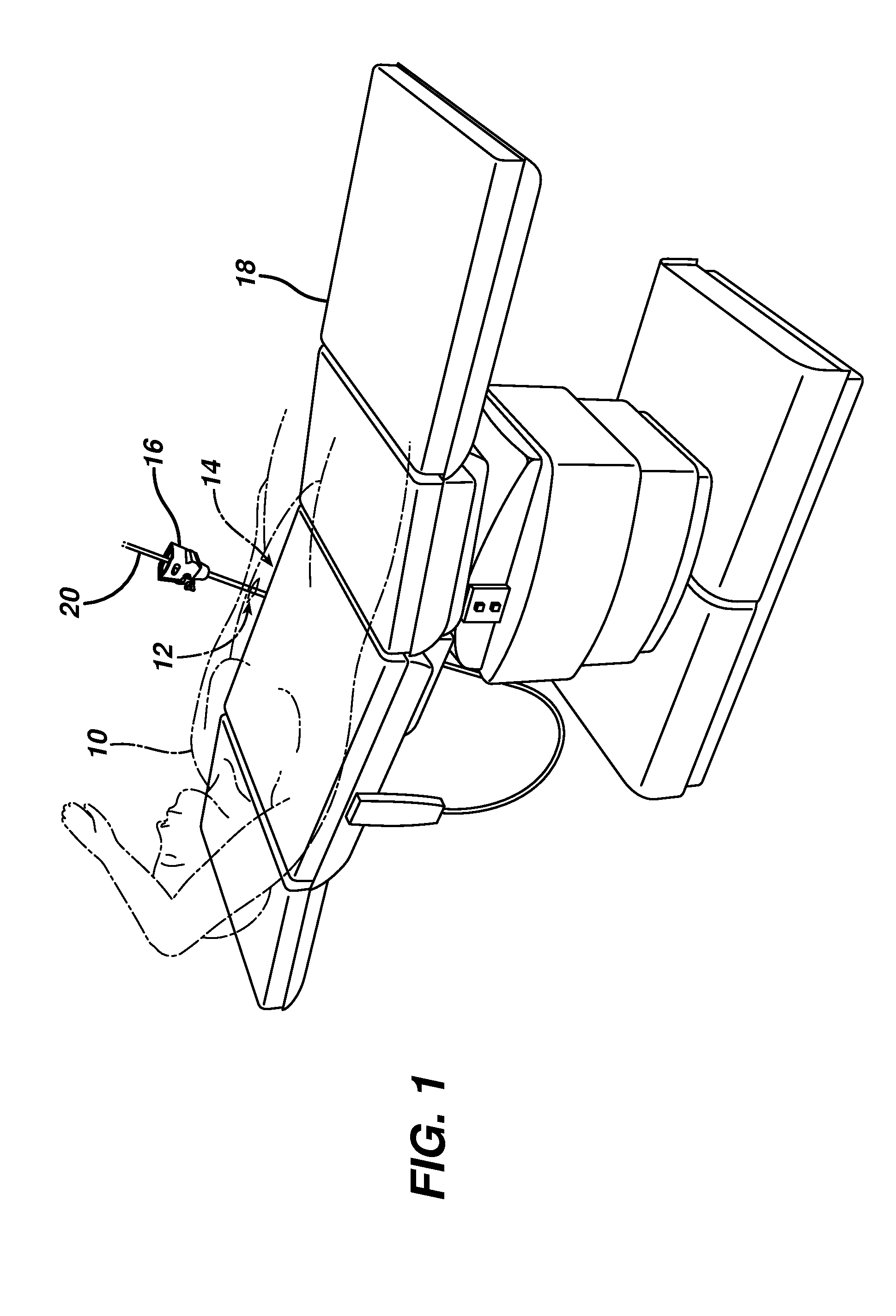 Methods and devices for performing gastrectomies and gastroplasties