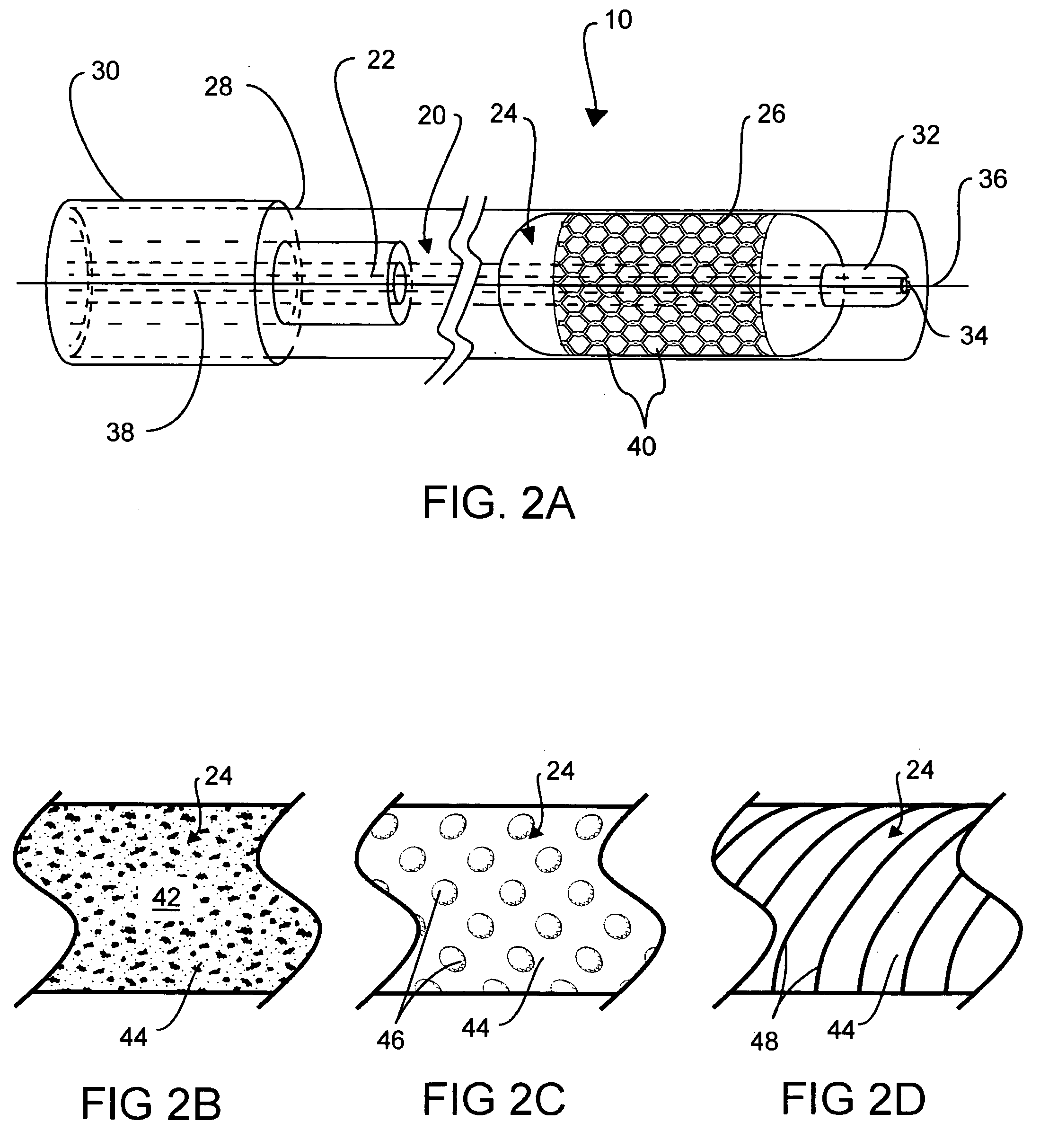 Intraluminal stent assembly and method of deploying the same